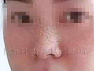 暗黃